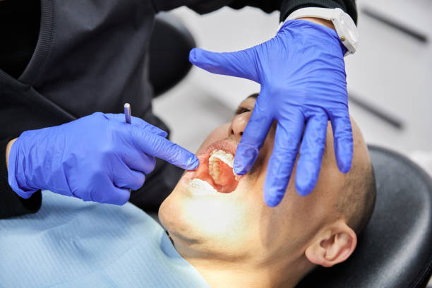 Teeth Whitening in NY